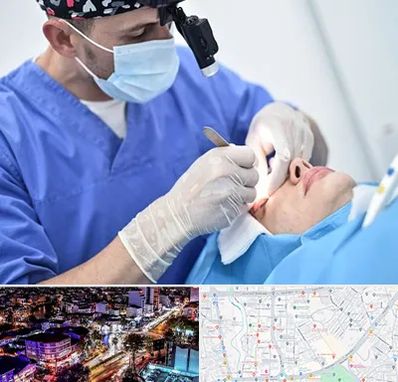 جراح سرطان چشم در منظریه رشت 