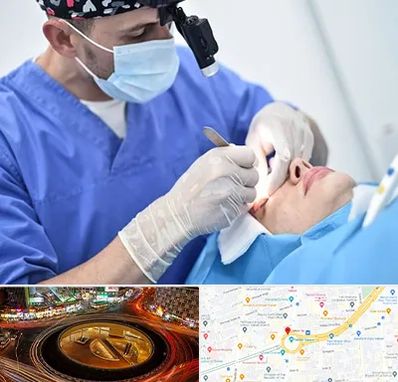 جراح سرطان چشم در میدان ولیعصر 