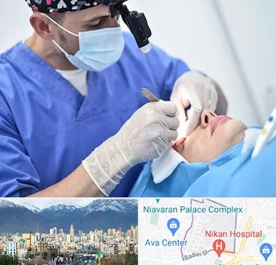 جراح سرطان چشم در آجودانیه 