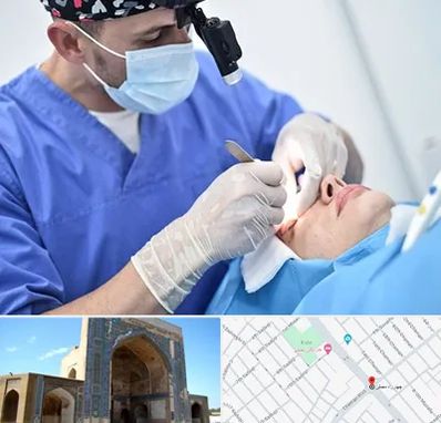 جراح سرطان چشم در مصلی مشهد