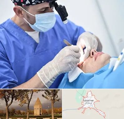 جراح سرطان چشم در تویسرکان