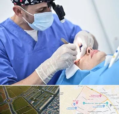 جراح سرطان چشم در الهیه مشهد 