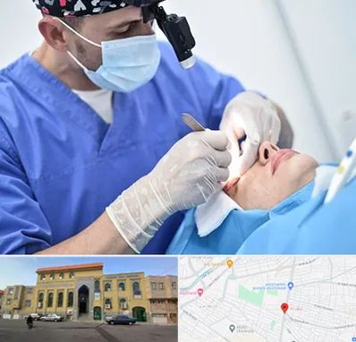 جراح سرطان چشم در زنبیل آباد قم