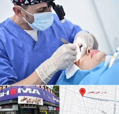 جراح سرطان چشم در امین حضور