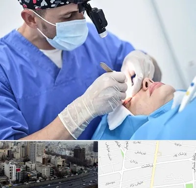 جراح سرطان چشم در زرتشت