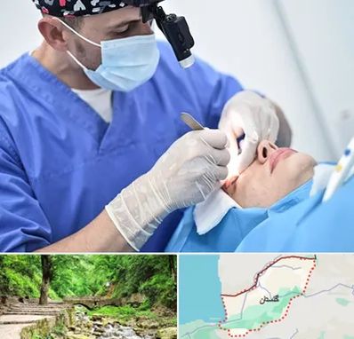 جراح سرطان چشم در گلستان