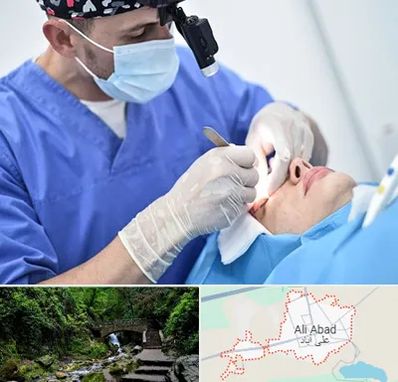 جراح سرطان چشم در علی آباد کتول