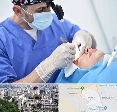 جراح سرطان چشم در ولنجک 