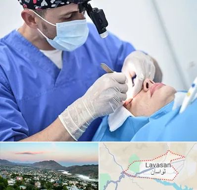 جراح سرطان چشم در لواسان