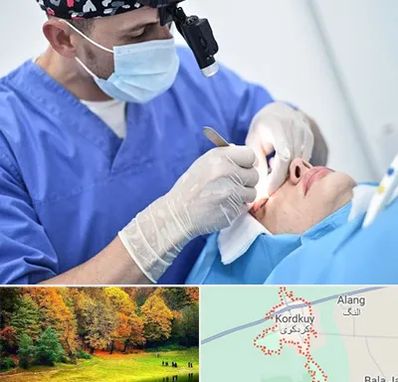 جراح سرطان چشم در کردکوی