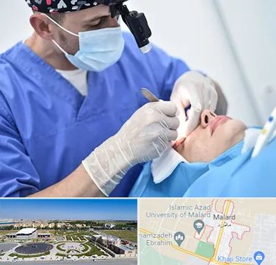 جراح سرطان چشم در ملارد