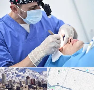 جراح سرطان چشم در ازگل