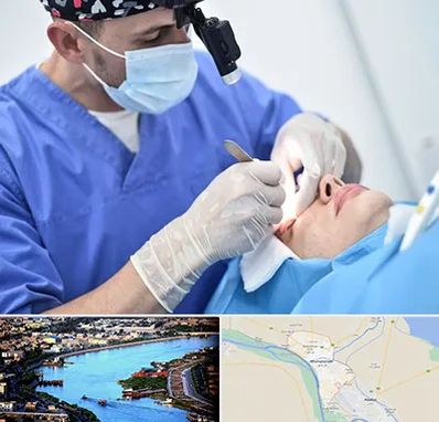 جراح سرطان چشم در خرمشهر