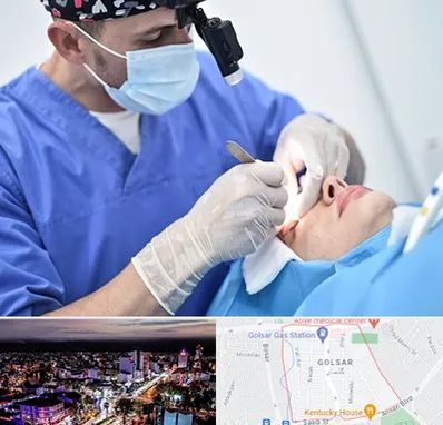 جراح سرطان چشم در گلسار رشت 