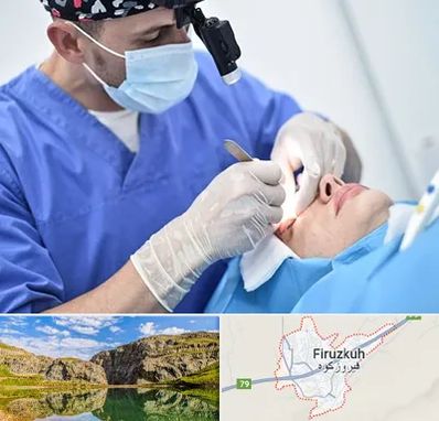 جراح سرطان چشم در فیروزکوه