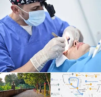 جراح سرطان چشم در فلکه گاز رشت 