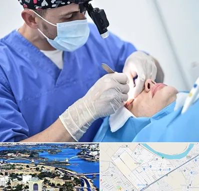 جراح سرطان چشم در کوروش اهواز 