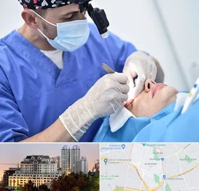 جراح سرطان چشم در فرشته 