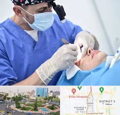 جراح سرطان چشم در ونک 