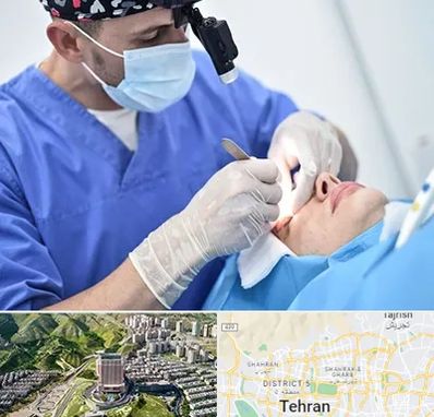 جراح سرطان چشم در شمال تهران 