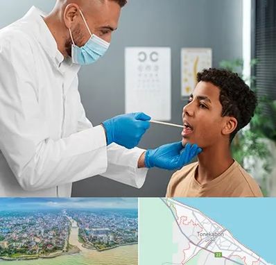 دکتر سرطان دهان در تنکابن