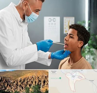 دکتر سرطان دهان در اسکو
