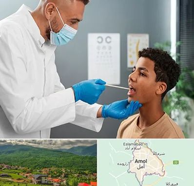 دکتر سرطان دهان در آمل