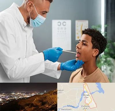 دکتر سرطان دهان در میناب