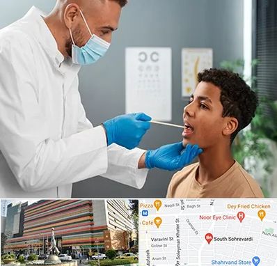 دکتر سرطان دهان در سهروردی 