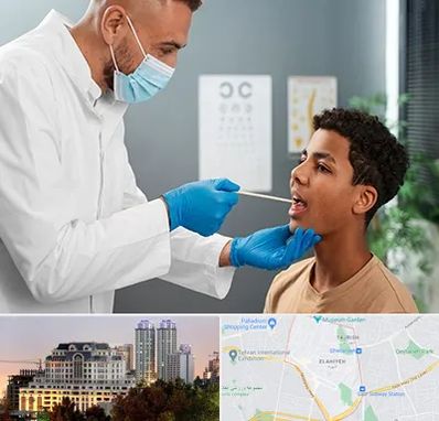 دکتر سرطان دهان در فرشته 