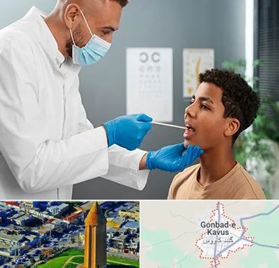 دکتر سرطان دهان در گنبد کاووس