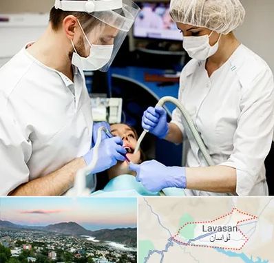 جراح سرطان دهان در لواسان