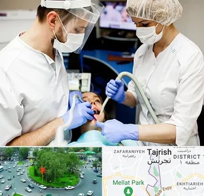 جراح سرطان دهان در تجریش 