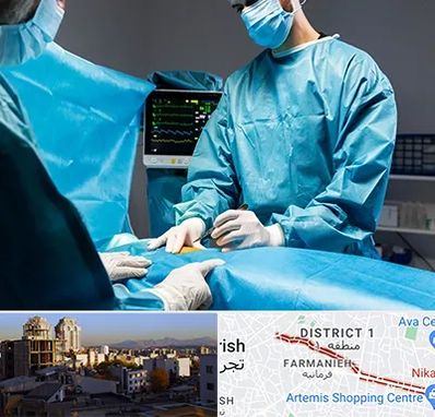 جراح سرطان کلیه در فرمانیه 