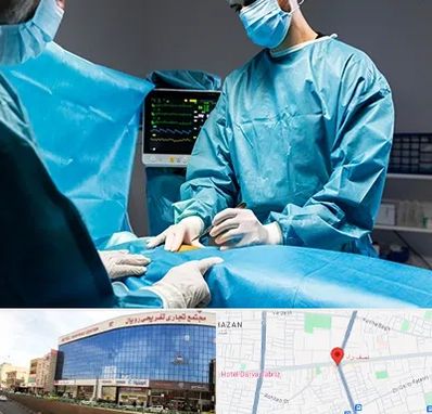 جراح سرطان کلیه در نصف راه تبریز