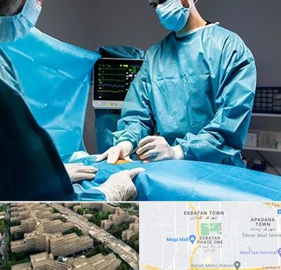 جراح سرطان کلیه در اکباتان 