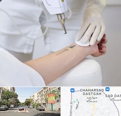 پاک کردن تتو با لیزر در چهارصد دستگاه