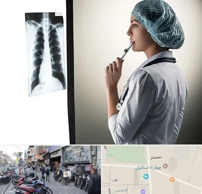 دکتر سرطان ریه در چهارراه استانبول
