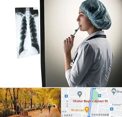 دکتر سرطان ریه در چهارباغ اصفهان 