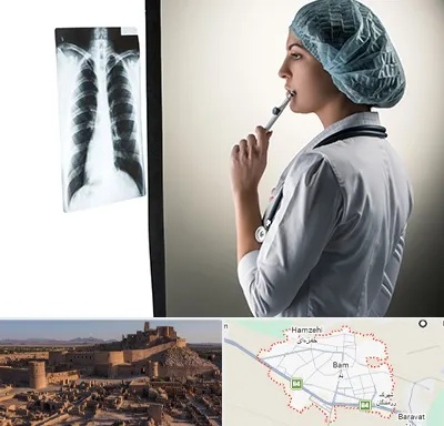 دکتر سرطان ریه در بم