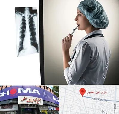 دکتر سرطان ریه در امین حضور