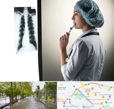 دکتر سرطان ریه در خیابان ارم شیراز 