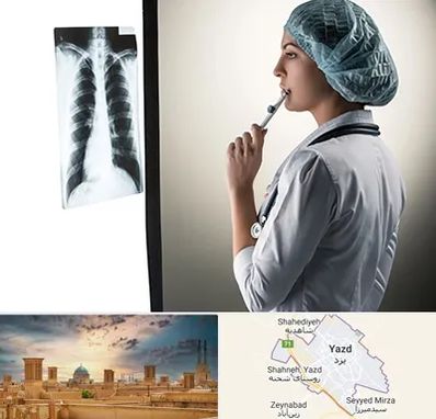 دکتر سرطان ریه در یزد