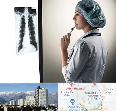 دکتر سرطان ریه در شهرک غرب 