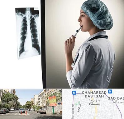 دکتر سرطان ریه در چهارصد دستگاه 