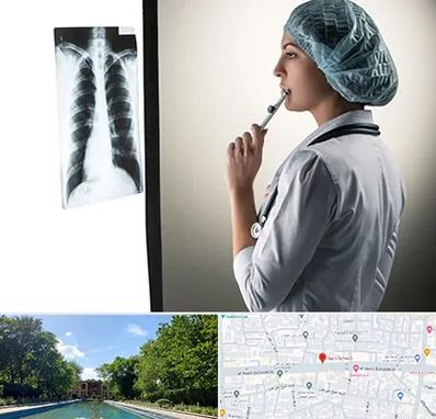 دکتر سرطان ریه در هشت بهشت اصفهان 