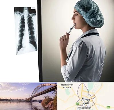 دکتر سرطان ریه در اهواز
