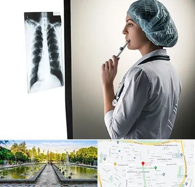 دکتر سرطان ریه در سرسبز 