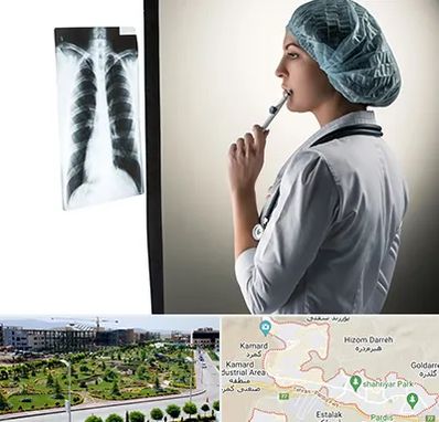 دکتر سرطان ریه در پردیس