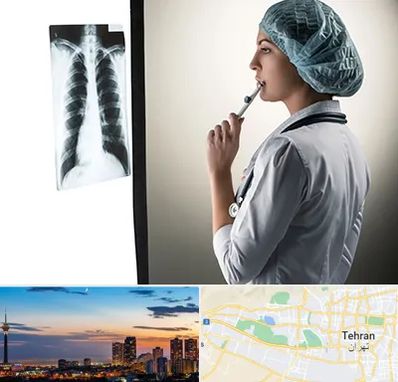 دکتر سرطان ریه در غرب تهران 